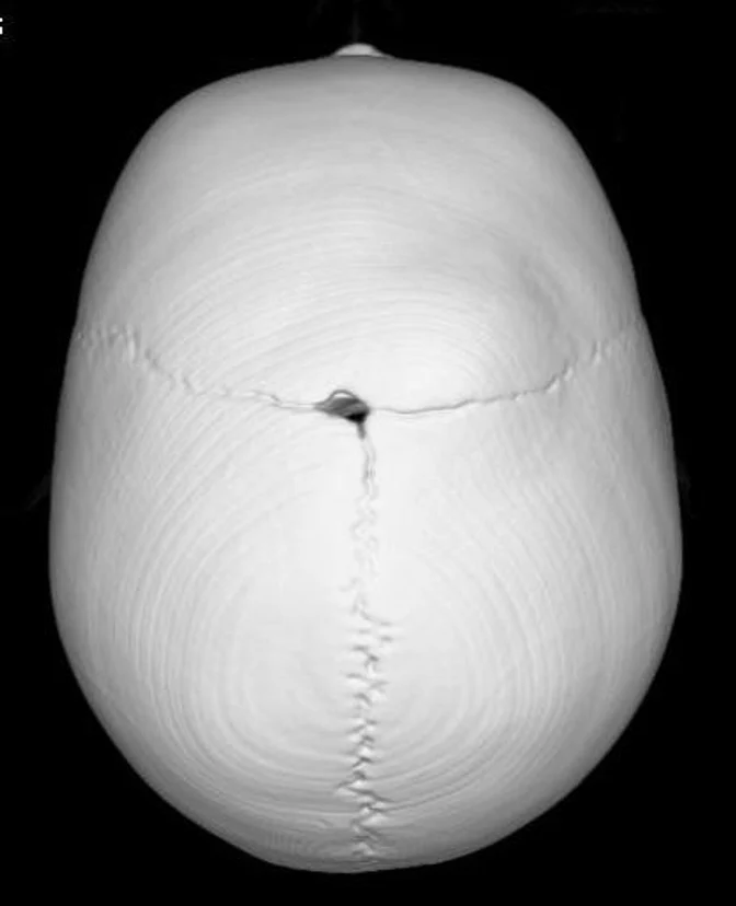 image-3