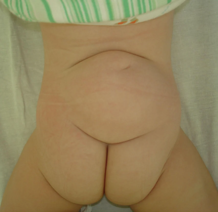 image-2