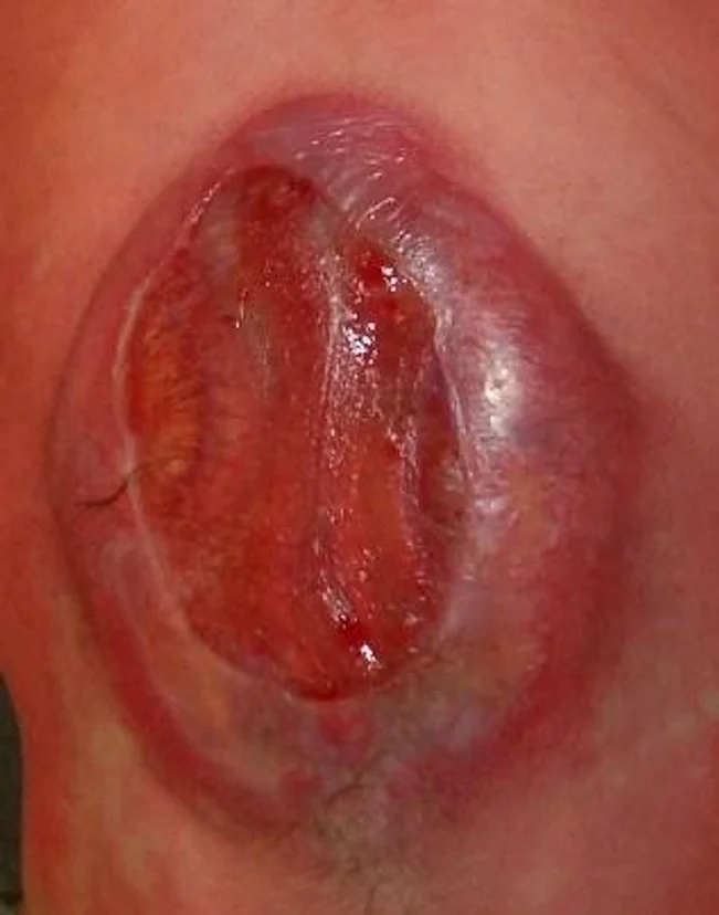 image-3