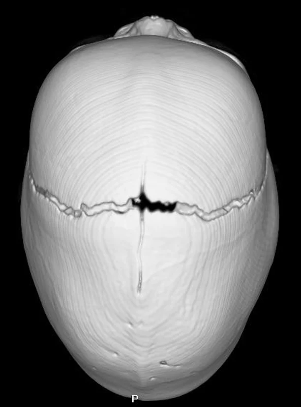 image-2